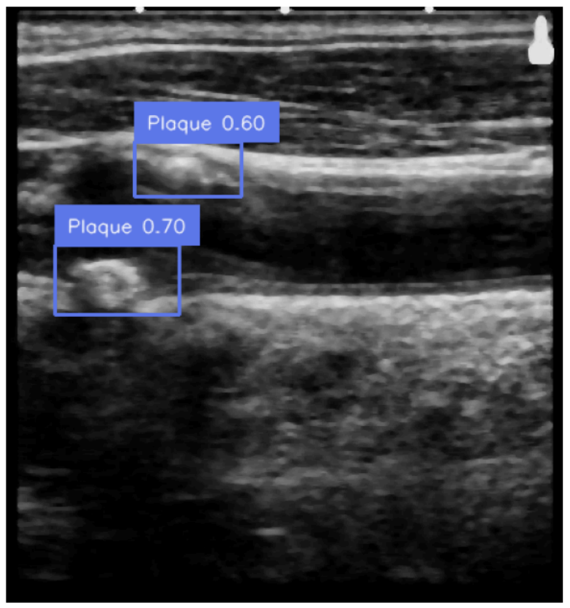 pub3_omarov_etal_ultrasound.png