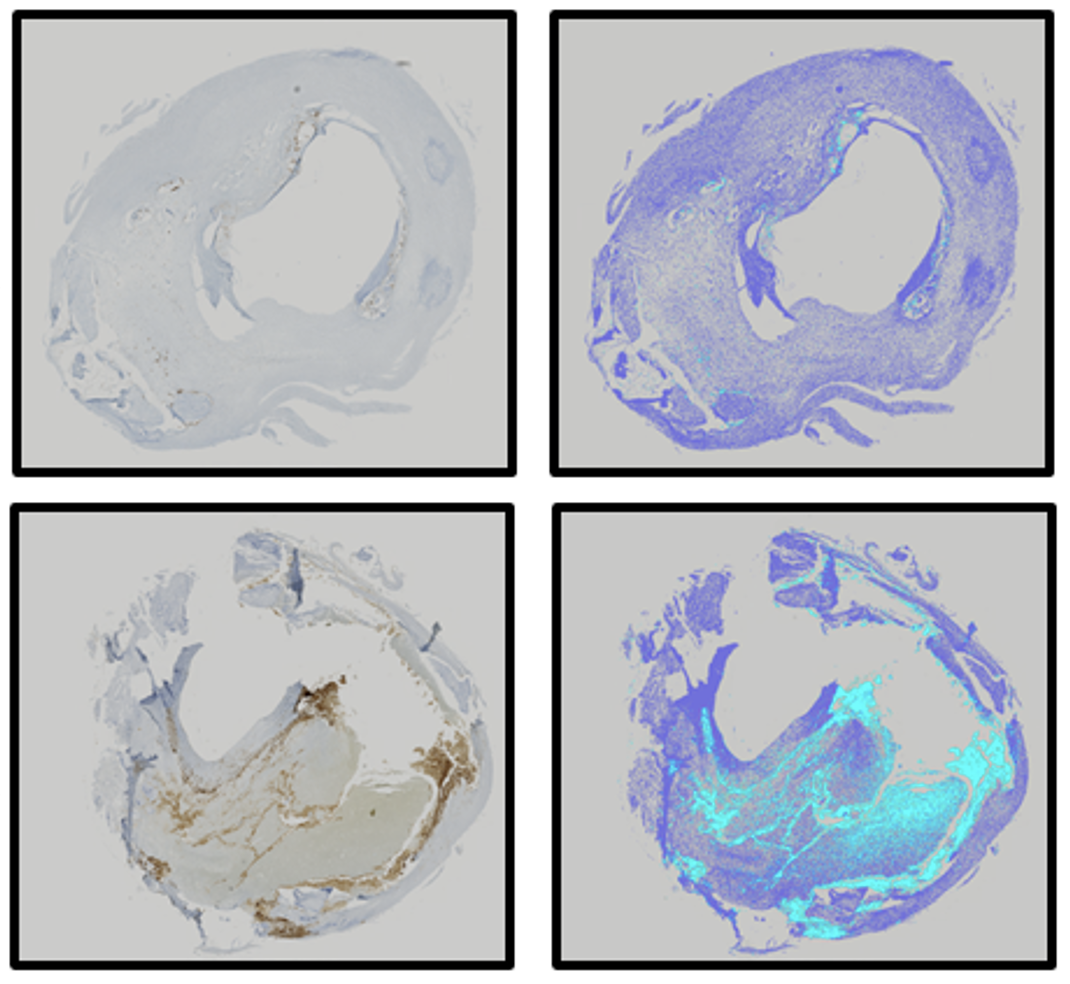 pub2_zivkovic_etal_atheromics.png