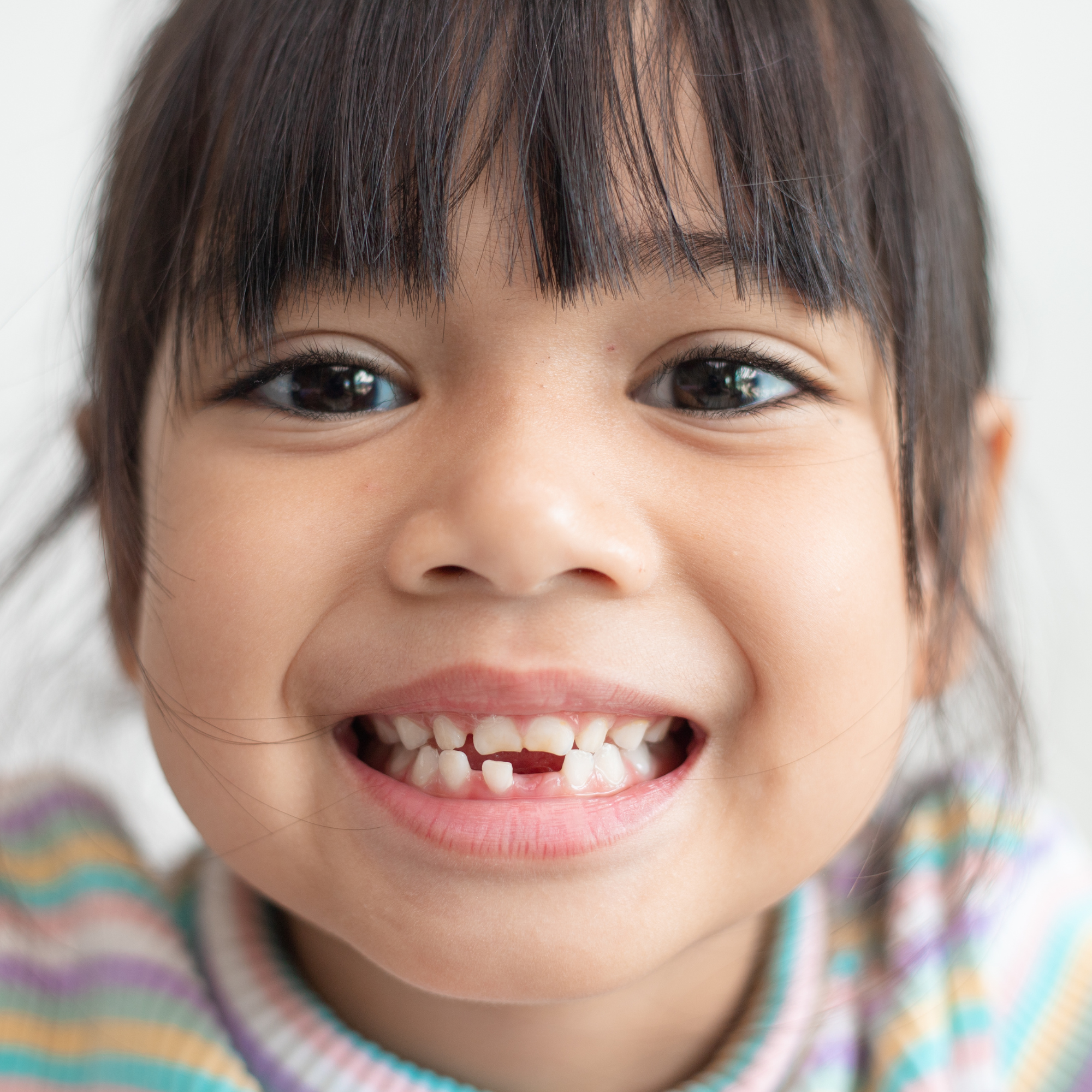 Why Baby Teeth Matter for Future Braces