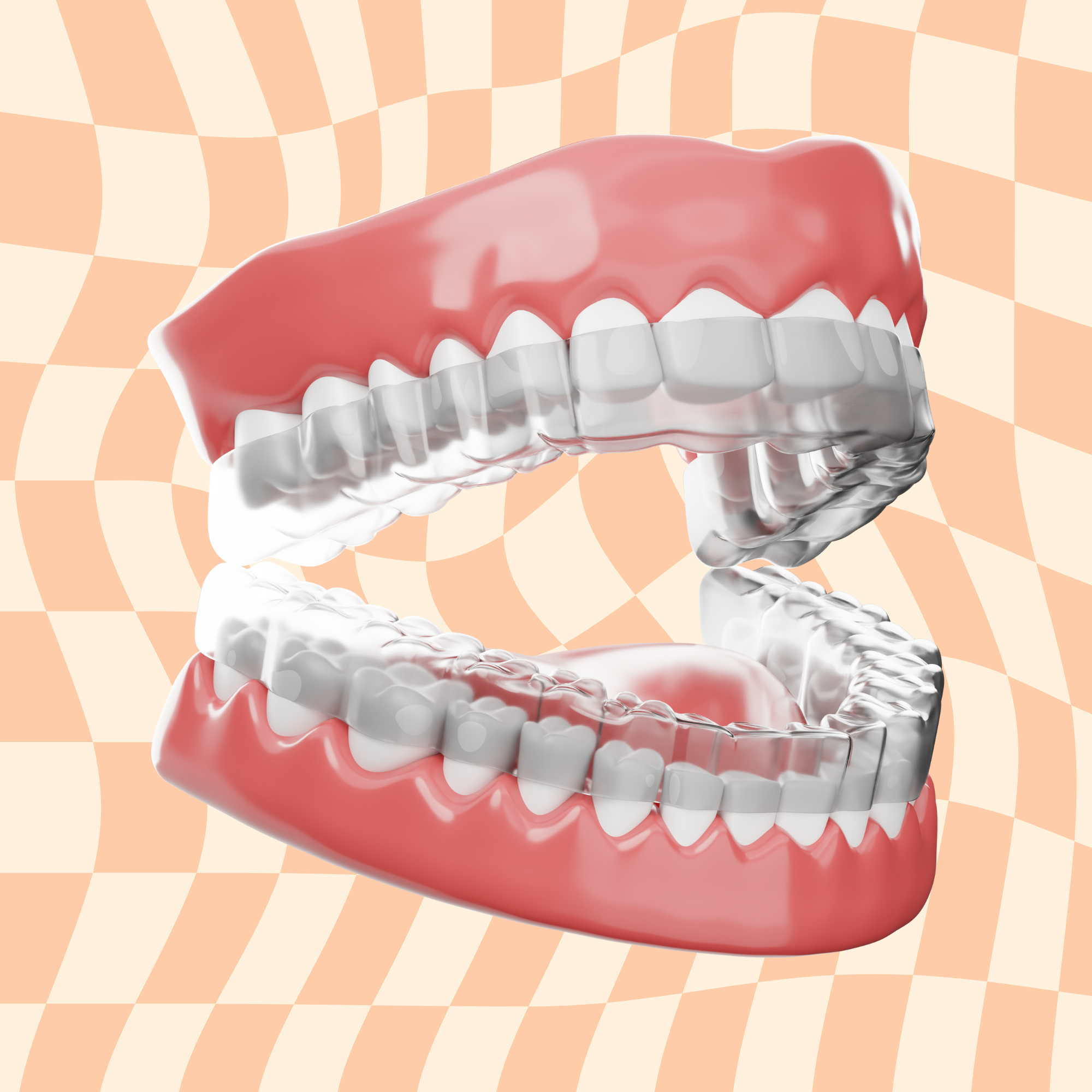 Worry Free Retainer Replacement Plan: Protect Your Smile for the Long Term