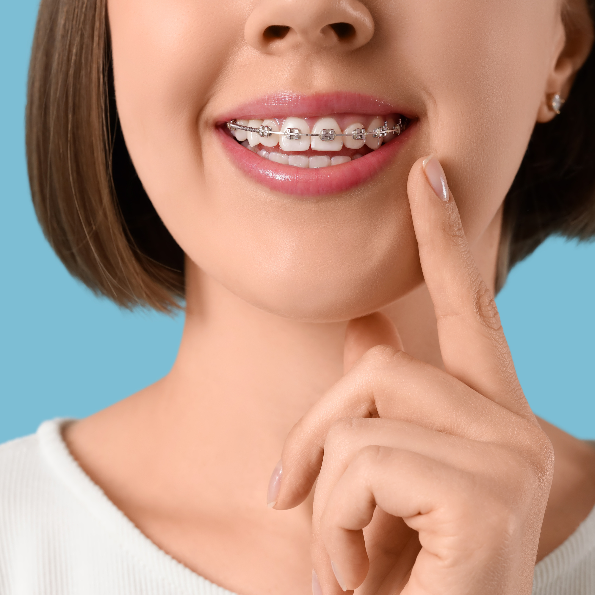 Why Waiting Too Long for Orthodontic Treatment Can Complicate Things