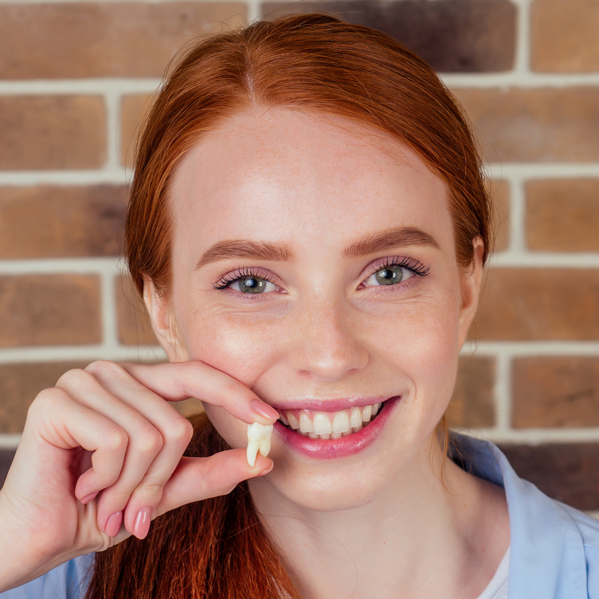 What Happens to Teeth When Wisdom Teeth Come In?