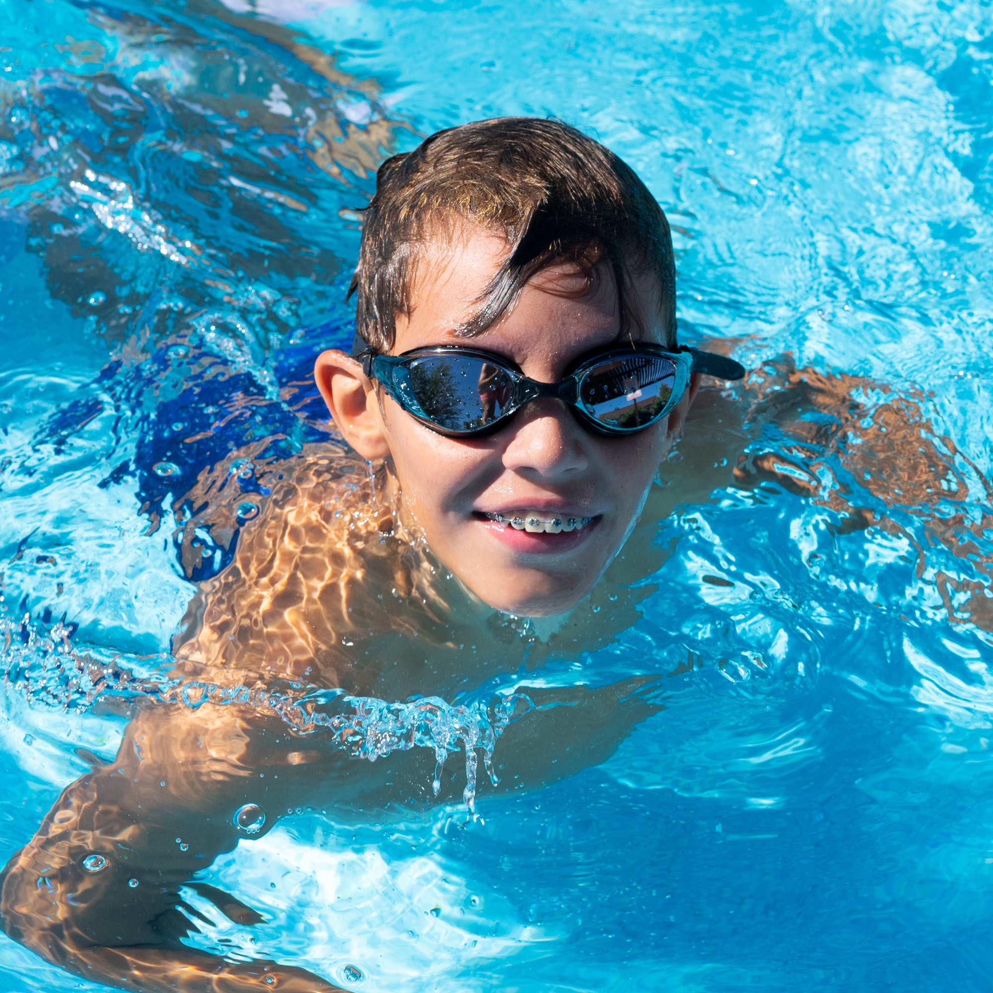 Why Summer Is One of the Best Times to Start Orthodontic Treatment