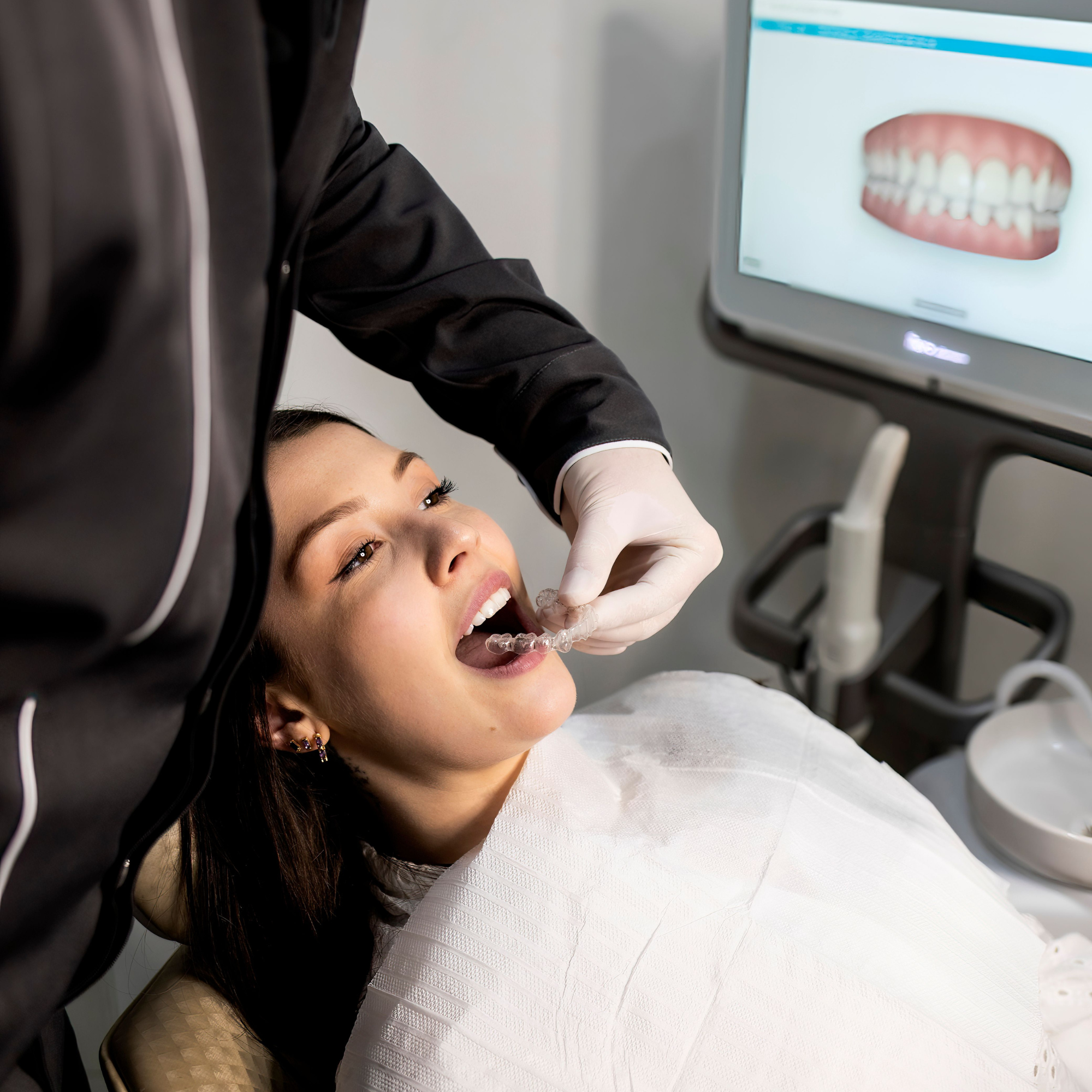 Are Clear Aligners Faster Than Braces?