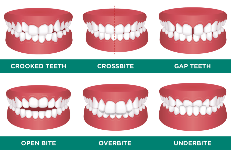 ABOUT ORTHO | Enhance Your Smile Today — Shine Ortho Studio