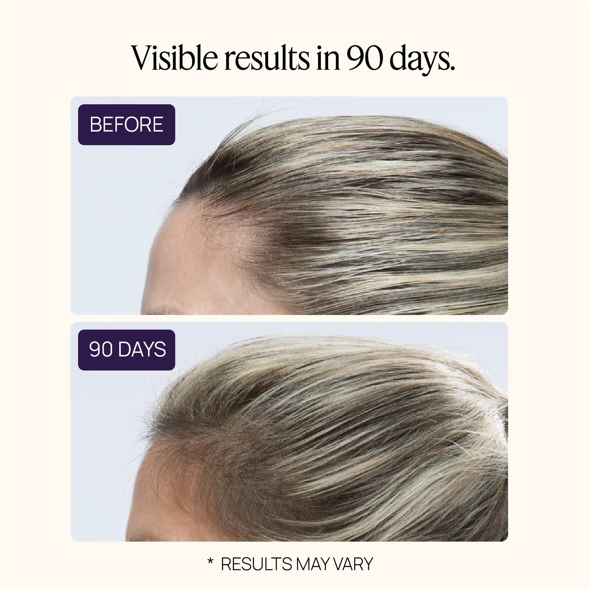 HAIR GROWTH SUPPLEMENT-$300 + FREE PRODUCT