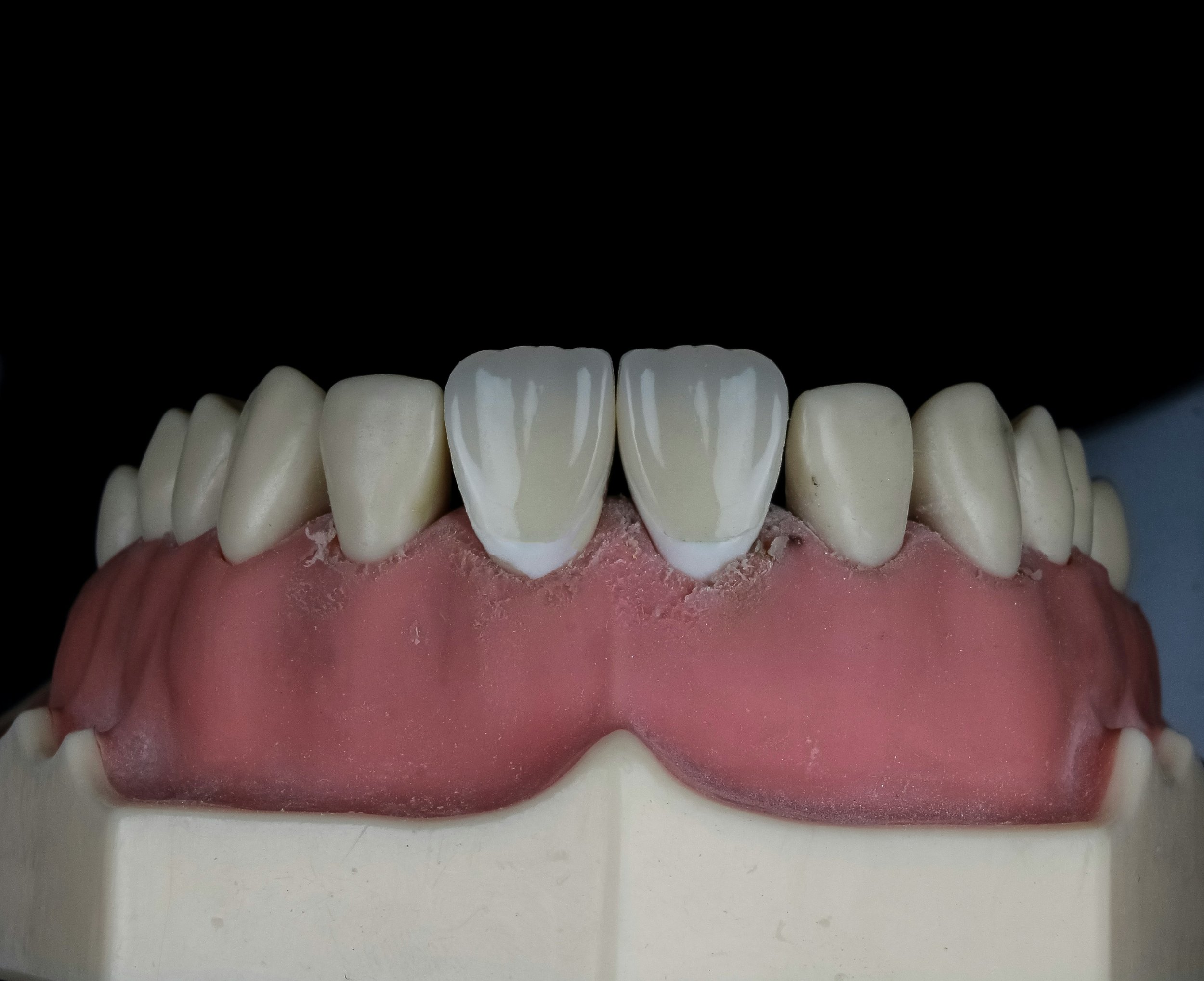 DENTAL PHOTOGRAPHY (1 DAYS COURSE)