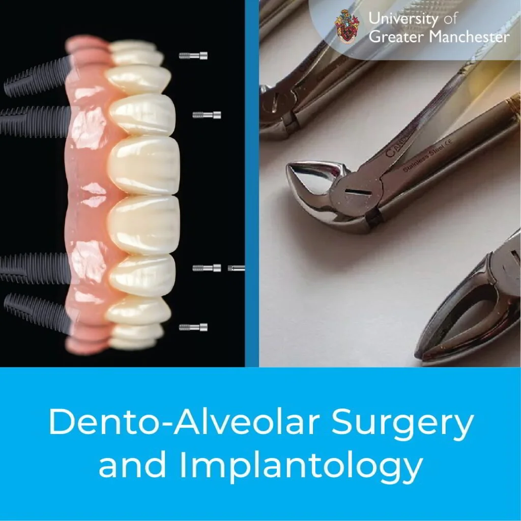 Dento-Alveolar-Surgery-and-Implantology1-1024x1024.jpg