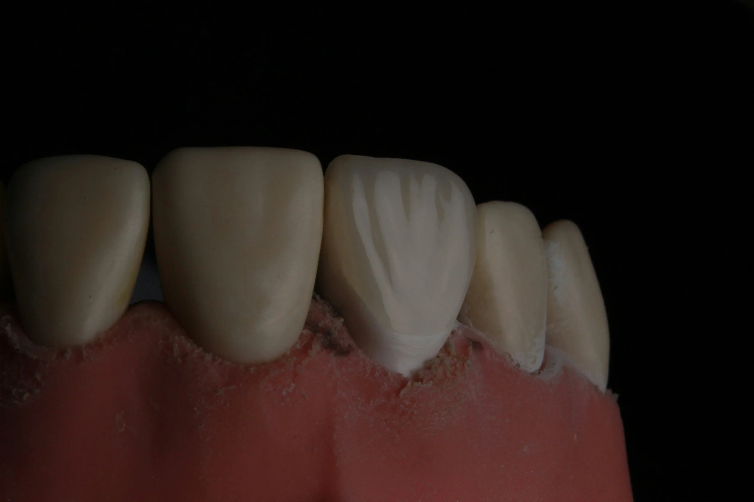 DENTAL PHOTOGRAPHY (LECTURE)