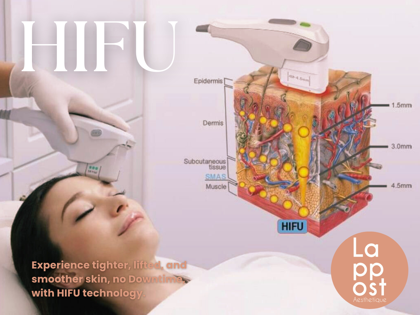 Medspa in Hayward, CA, 94541  Hifu Near Me