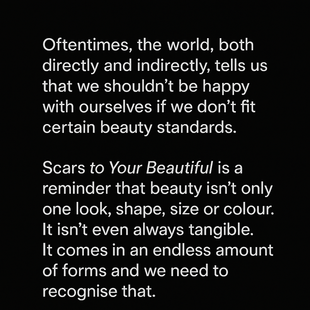 Alessia Cara - Scars To Your Beautiful
