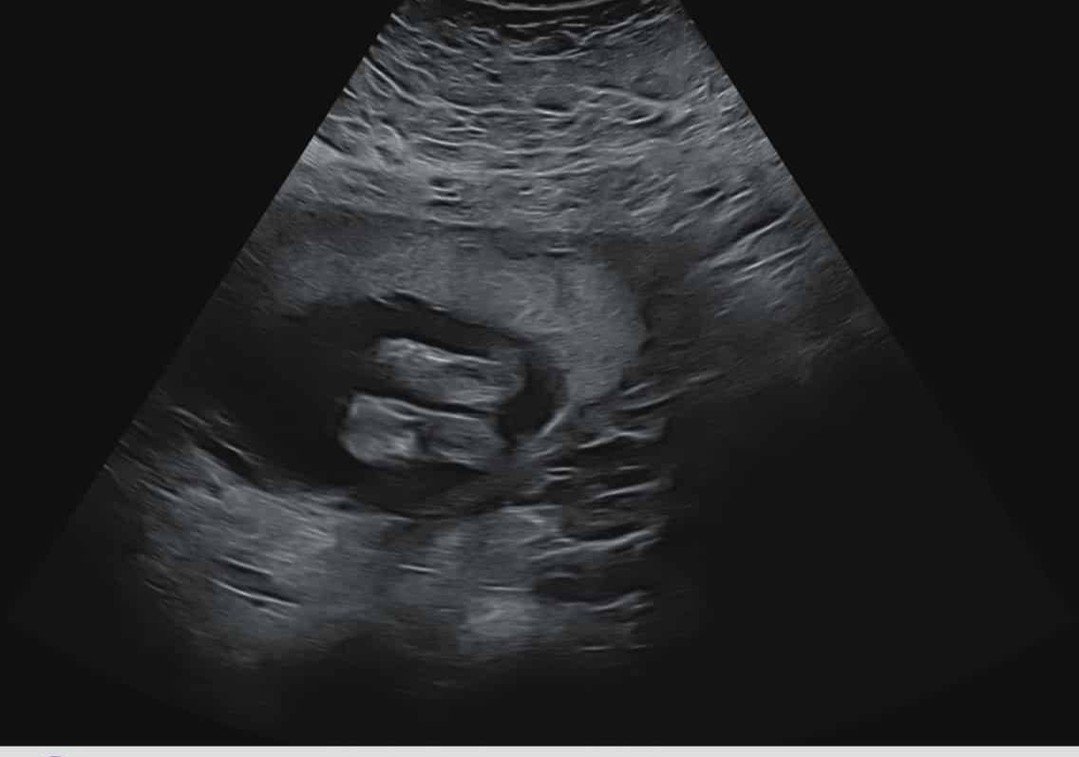 &ldquo;Is this ADHD&hellip; or just pregnancy?&rdquo; has become a regular internal broadcast over here, and honestly, half the time I still don&rsquo;t know the answer!

This season has been full of joy, exhaustion, plot twists, medication changes, 