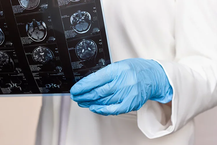 Doctors reviewing an MRI scan for precise injury diagnosis after an accident.