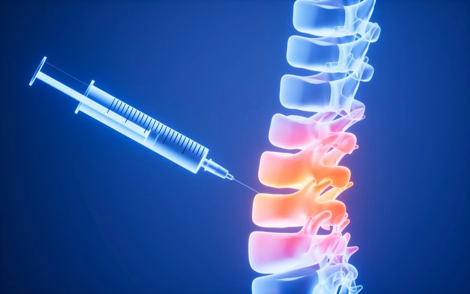 Injection therapy targeting the inflamed nerve near the spine