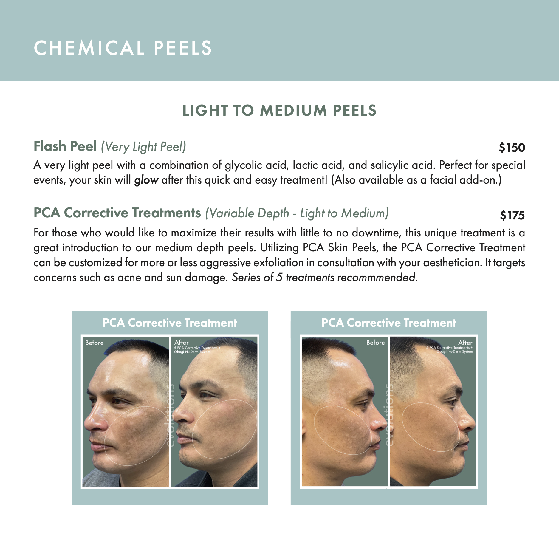 EMDS Day Spa Menu (with add-ons and enhancements) final (2) (dragged) 10.png