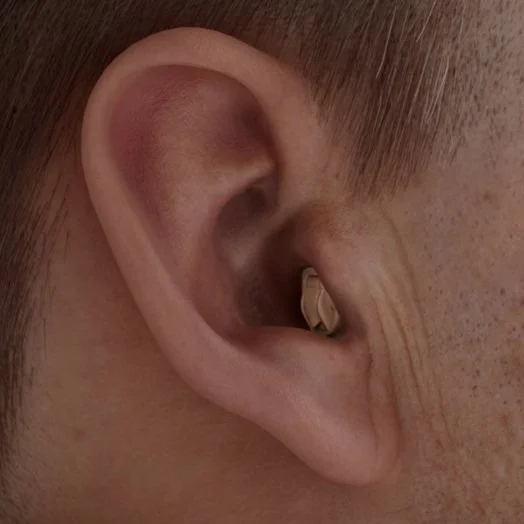 Close-up of a human ear with a cochlear implant.