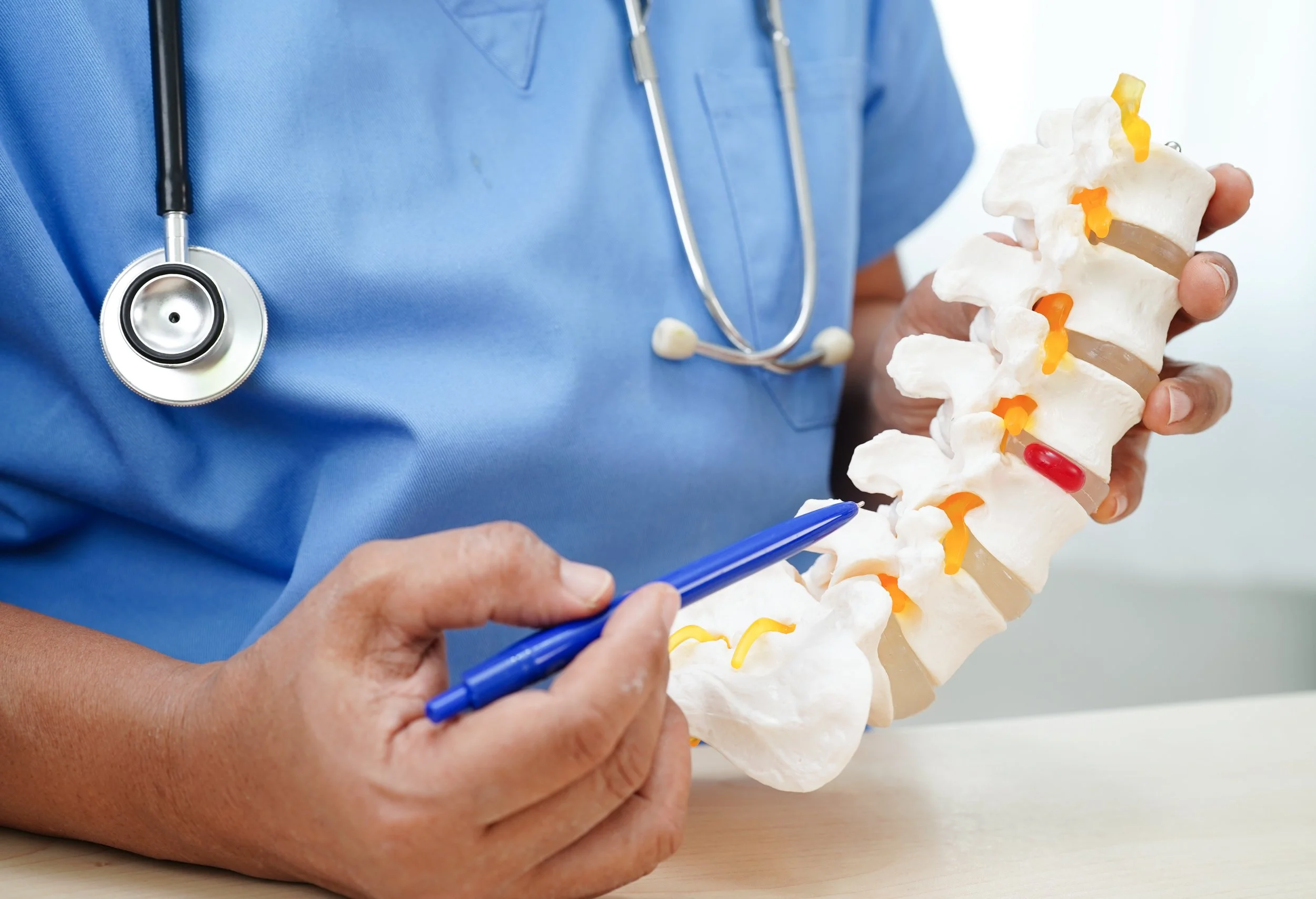 Médico a segurar uma maquete de vértebras da coluna vertebral, local onde a ciática ocorre.
