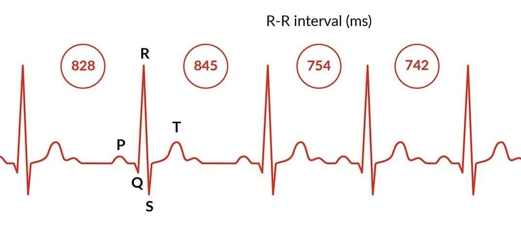 Che cos'è la variabilità della frequenza cardiaca (HRV)?