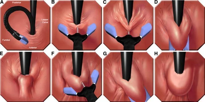 464_2009_723_Fig1_HTML.jpg