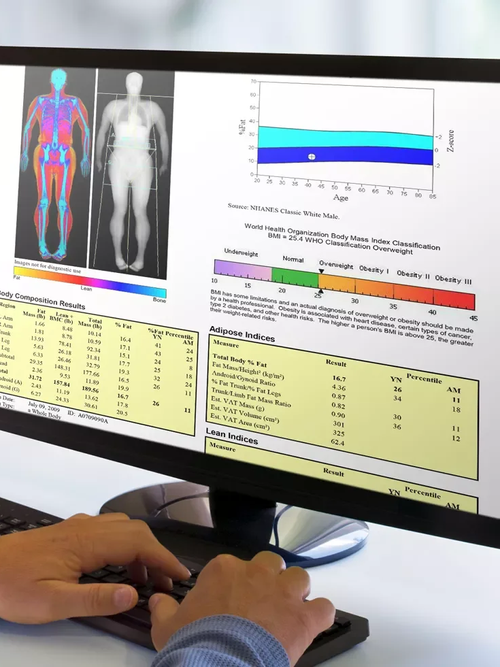 Dexa Scan Script Dexa Info | Enhance Your Health Today — Book a DEXA Scan — NOVA Body Lab