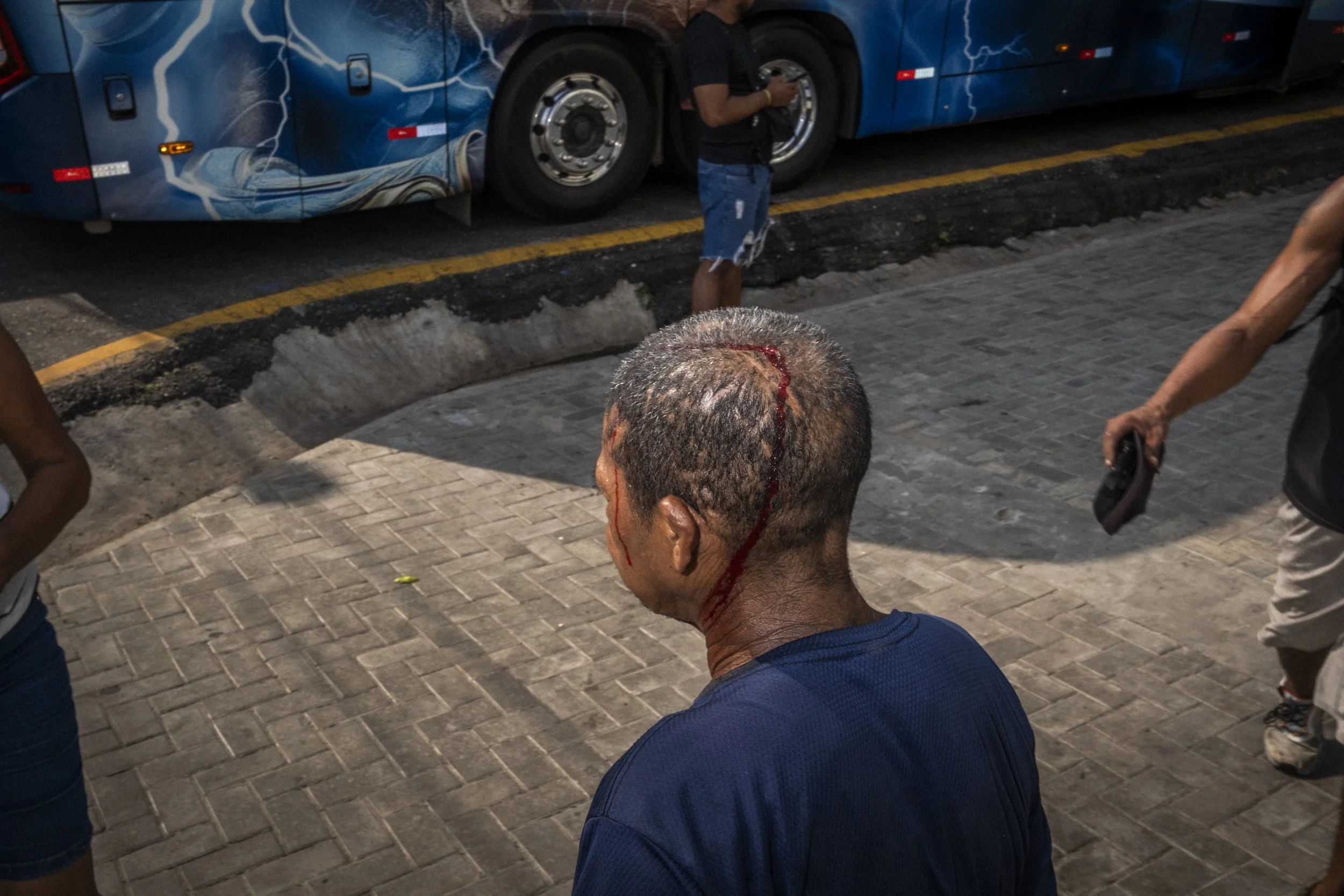 BELEM, BRAZIL - OCTOBER 25, 2025: Um homem com um ferimento sangrando na cabeça caminha pelo mercado do Ver-o-Peso, em Belém, Pará.

BELEM, BRAZIL - OCTOBER 25, 2025: A man with a bleeding head wound walks through the Ver-o-Peso market in Belém, Pará