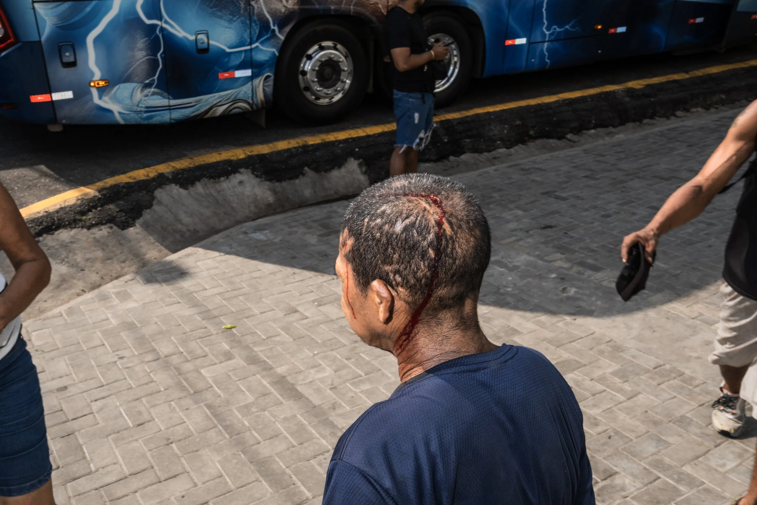 Um homem com um ferimento sangrando na cabeça caminha pelo mercado do Ver-o-Peso, em Belém, Pará.