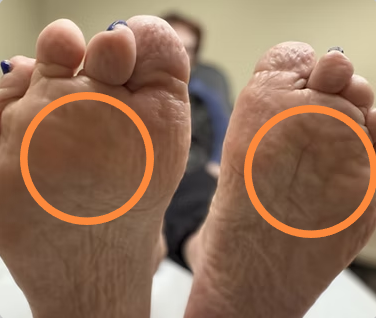 Close-up of the soles of two feet with the heels facing upward, highlighting the arch and heel areas.