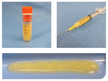 A small vial with yellow liquid, a syringe with yellow liquid on a blue background, and a yellowish gel-like substance on a flat surface.
