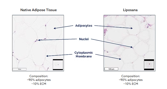 Comparison of native adipose tissue and liposana showing adipocytes, nuclei, and cytoplasmic membranes.