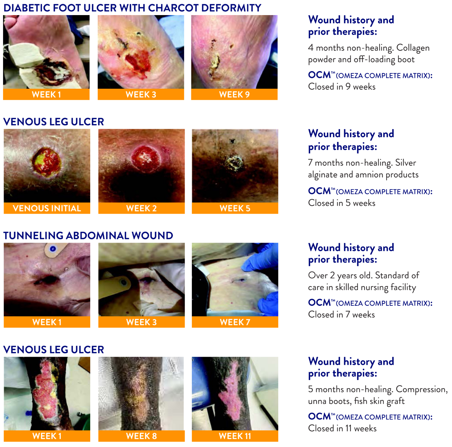 Photographs showing healing progress of various wounds over weeks. The first row documents a diabetic foot ulcer with charcot deformity healing from week 1 to week 9. The second row shows a venous leg ulcer healing from initial state to week 5. The third row depicts a tunneling abdominal wound healing from week 1 to week 11.