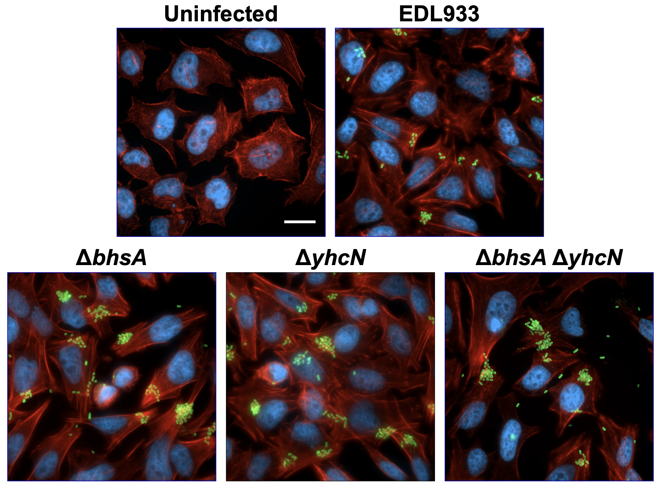Microscopic images of cells highlighting uninfected cells, cells infected with EDL933, and cells with gene deletions showing differences in green fluorescent markings indicating genetic or infection status.