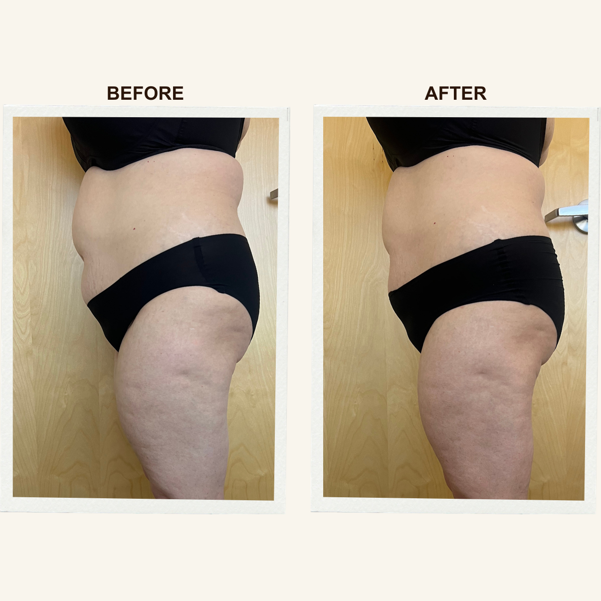 Posture and alignment results after Sculpting Lymphatic Massage at KIKOSPA, San Diego