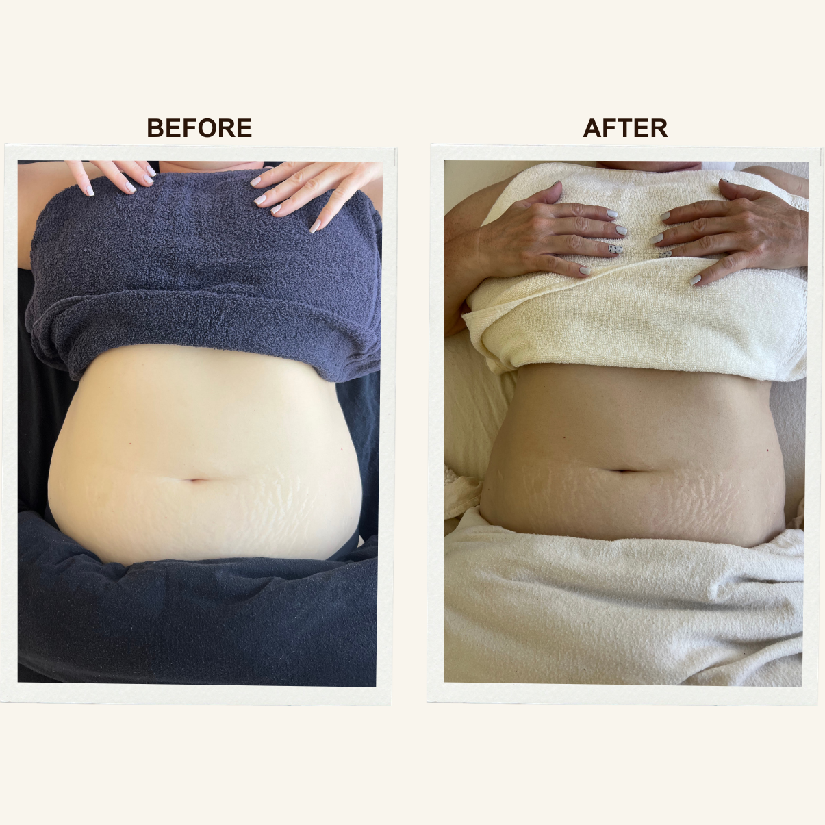Stomach contour results after a Sculpting Lymphatic Massage session at KIKOSPA.