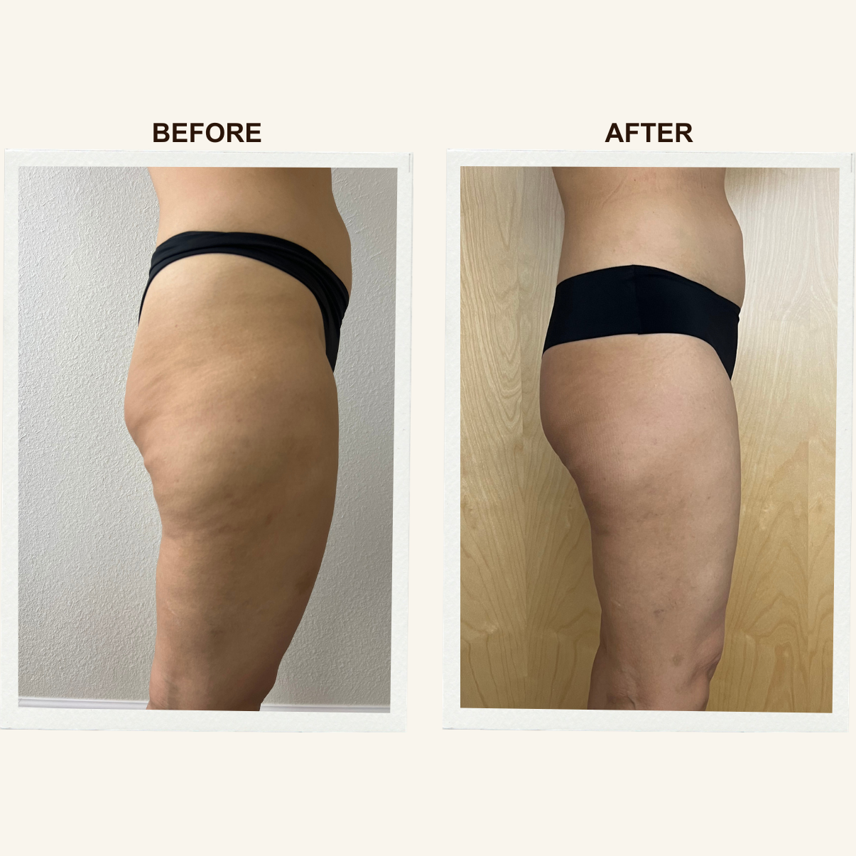 Legs before and after a Sculpting Lymphatic Massage session at KIKOSPA, San Diego.