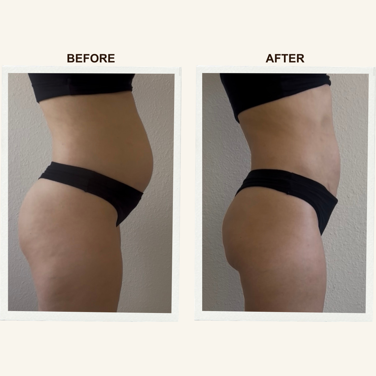 Posture results after a Sculpting Lymphatic Massage session at KIKOSPA