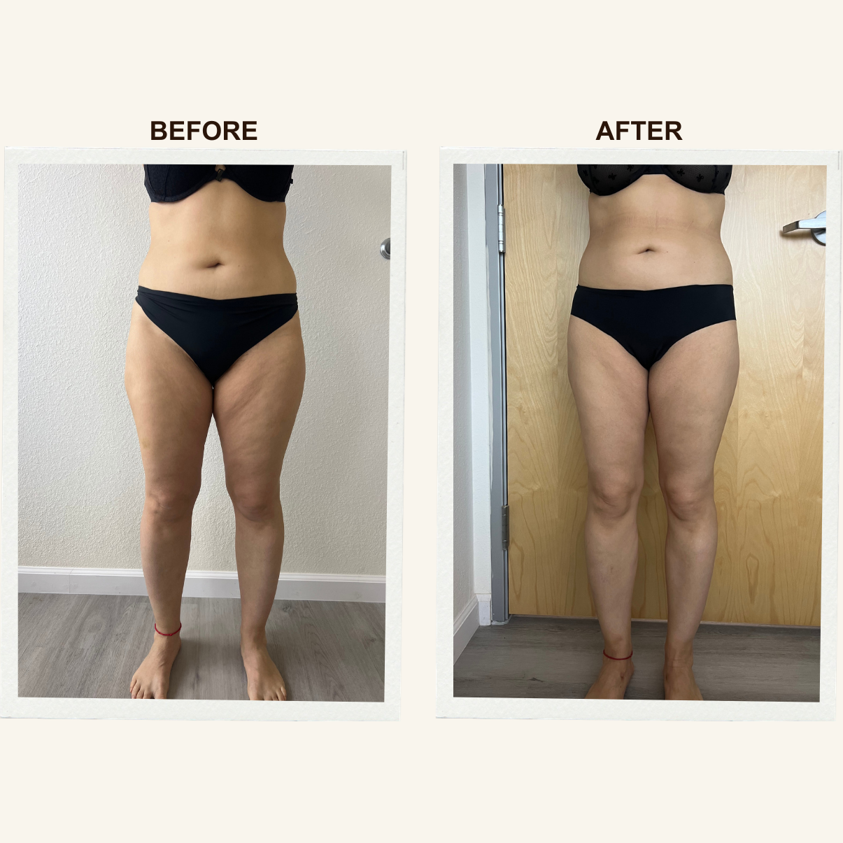 Leg contour results after a Sculpting Lymphatic Massage session at KIKOSPA.