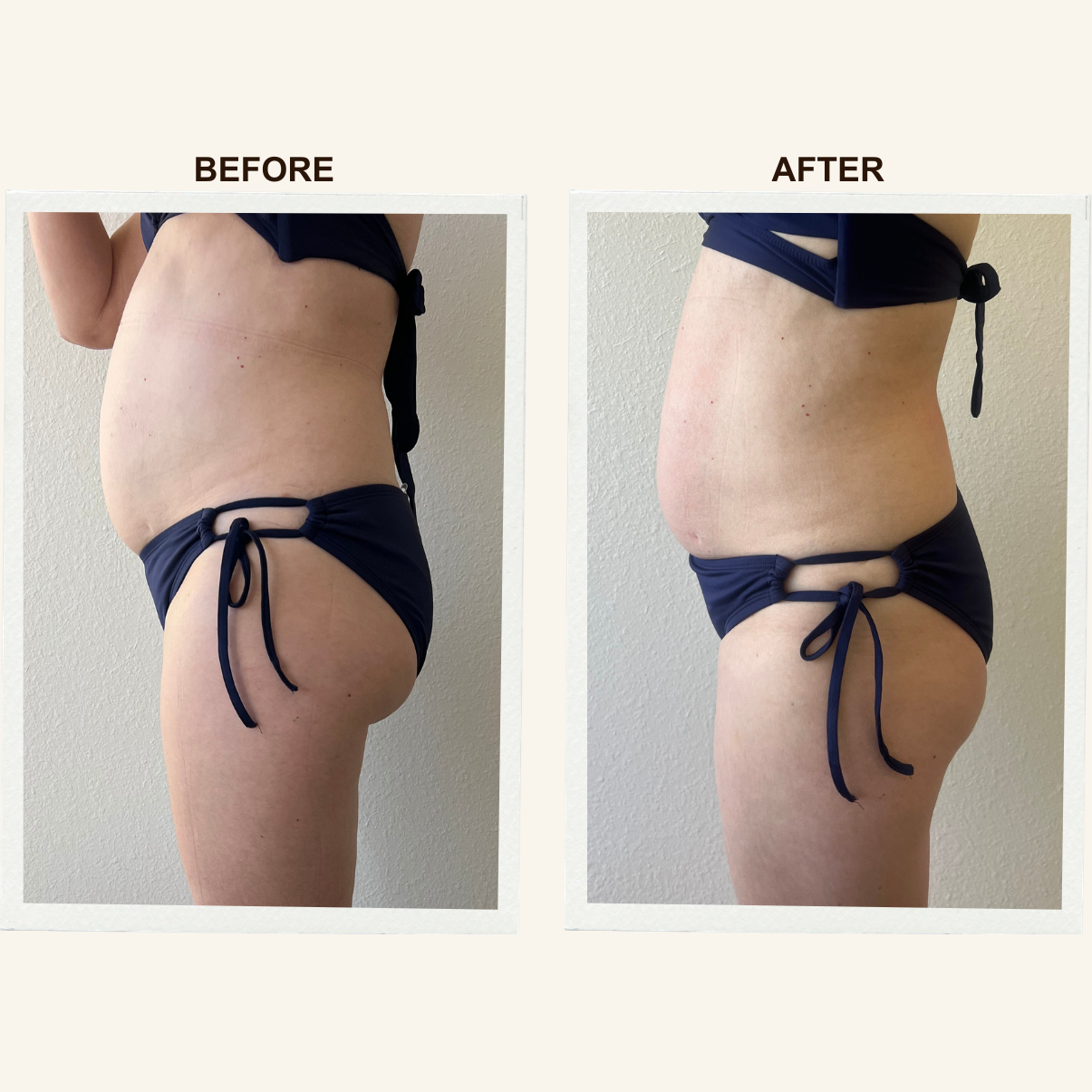 Posture before and after a Sculpting Lymphatic Massage session at KIKOSPA, San Diego