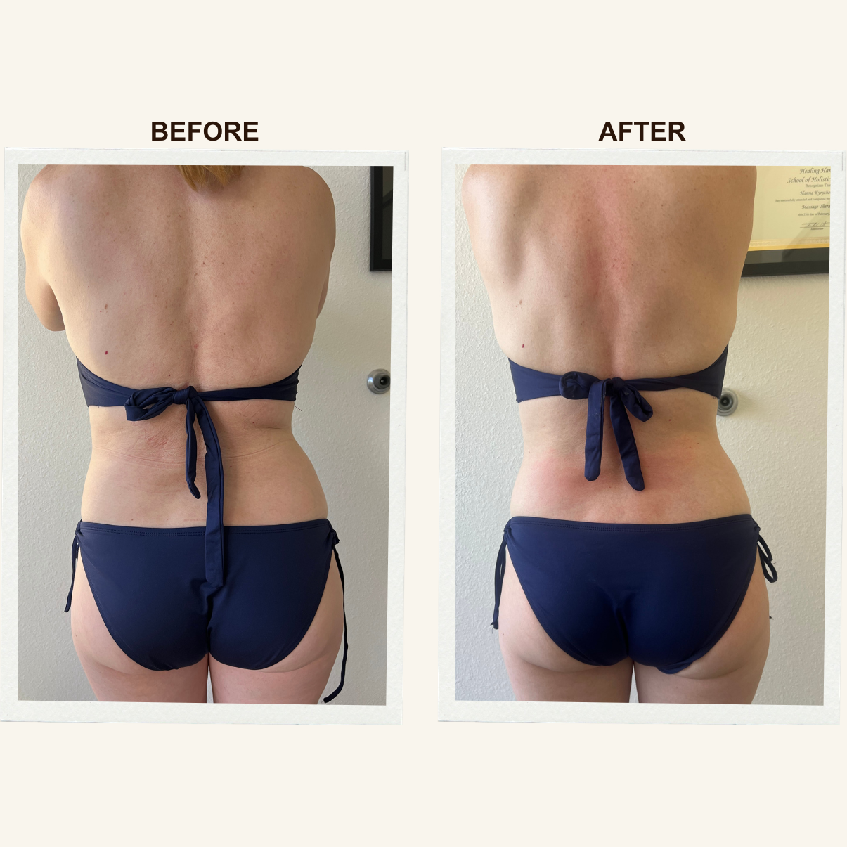 Back before and after a Sculpting Lymphatic Massage session at KIKOSPA, San Diego