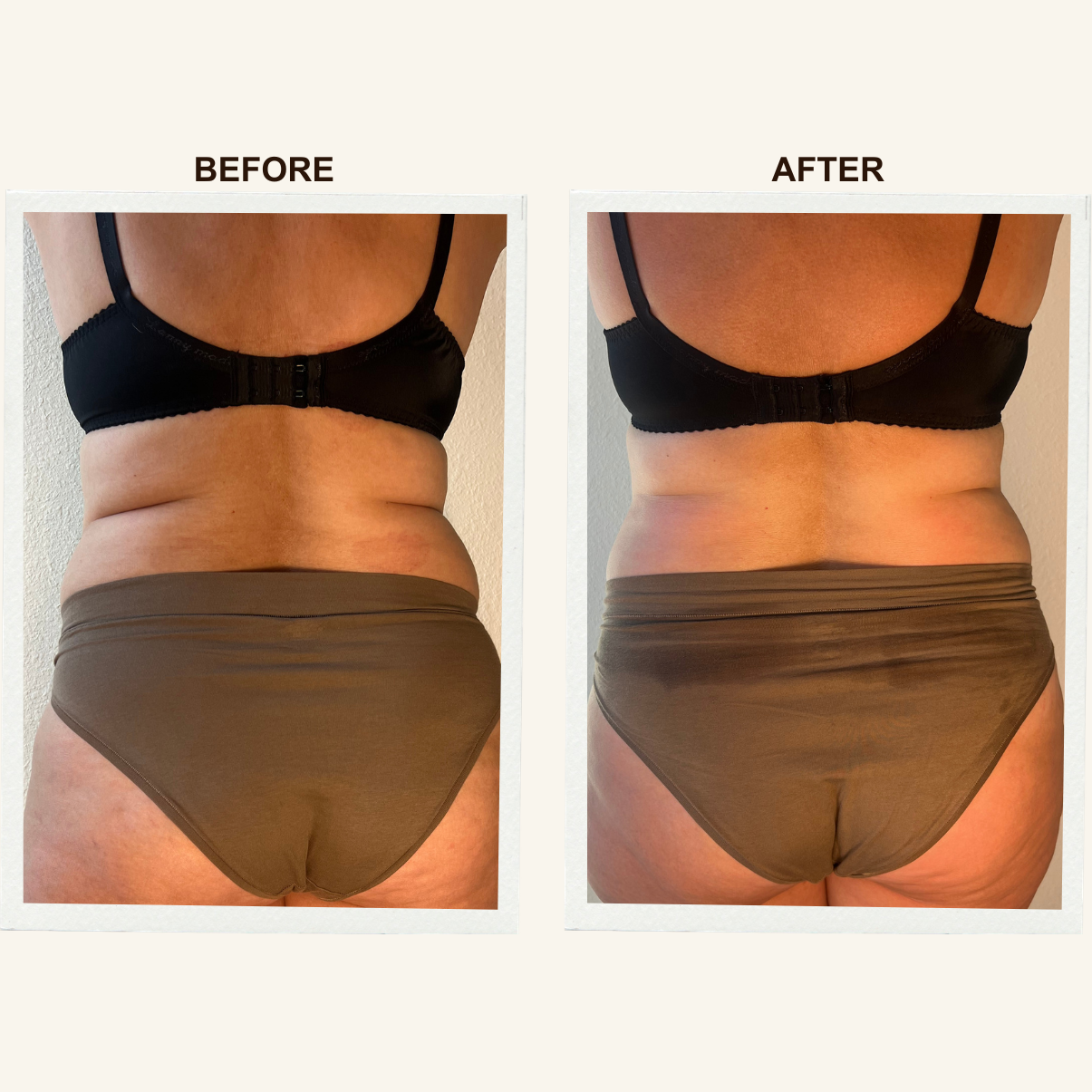 Back before and after a Sculpting Lymphatic Massage session at KIKOSPA, San Diego