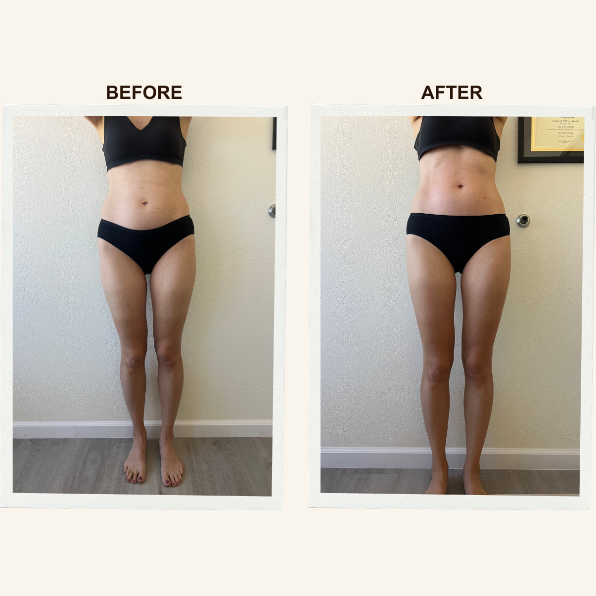 Body contour results after a Sculpting Lymphatic Massage session at KIKOSPA