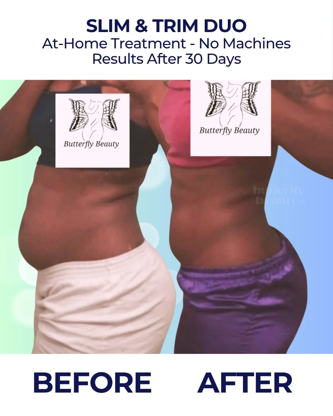 ✨ Slim &amp; Trim Duo Transformation ✨
Real results. Real confidence. Ready to start your glow-up? 💖

🎁 Join our giveaway for a chance to win the Slim &amp; Trim Duo Kit &mdash; featuring our fat dissolve lotion + oral drops!

Enter now and let you