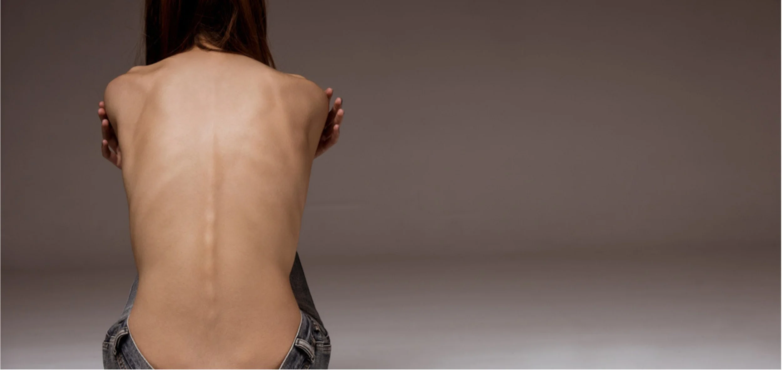 Underweight or Malnourished