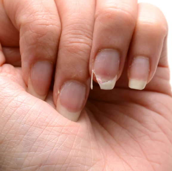 Why Are My Nails Breaking So Easily?