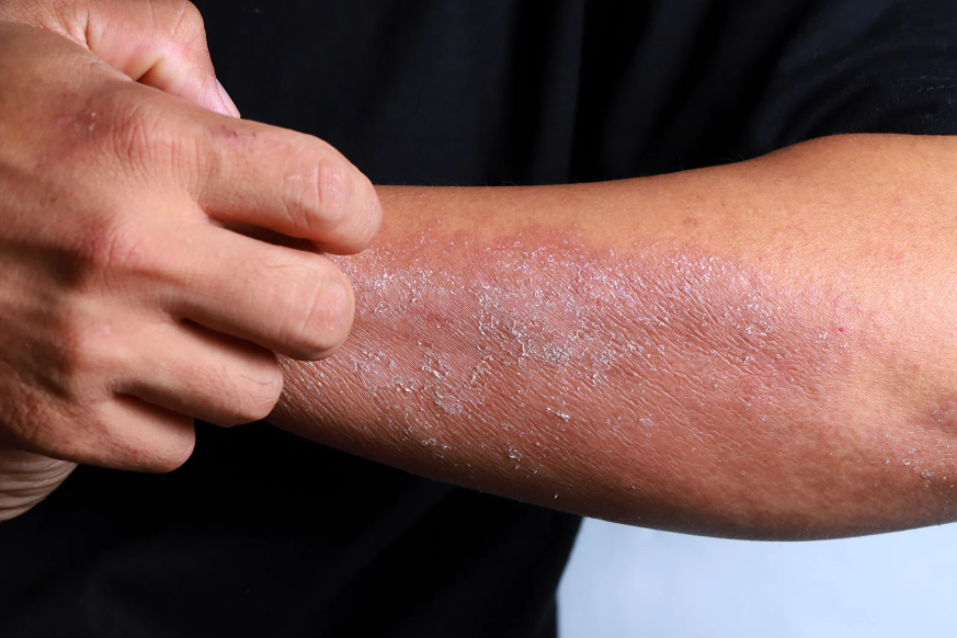 Why Is My Skin So Dry? 