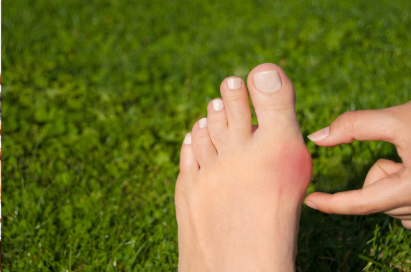 What Can Your Feet Tell You About Your Health?