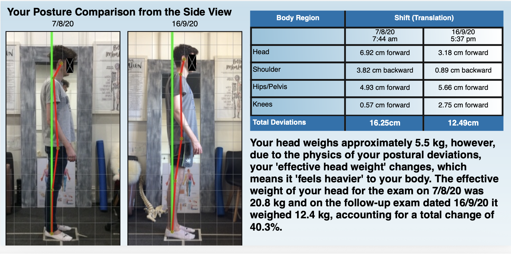 before and after posture screen results
