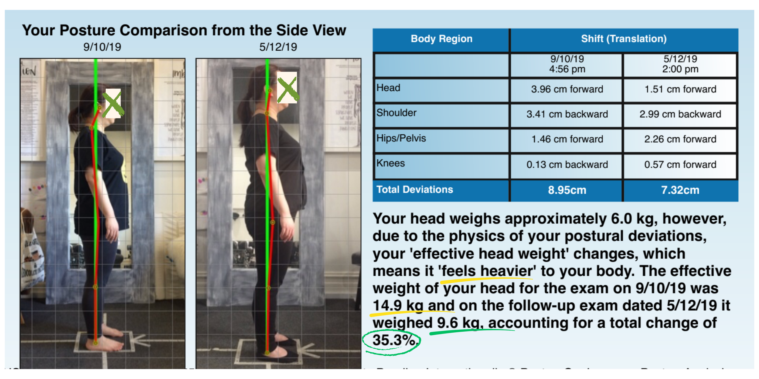digital postural analysis - before and after