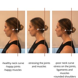 how do i fix forward head posture?