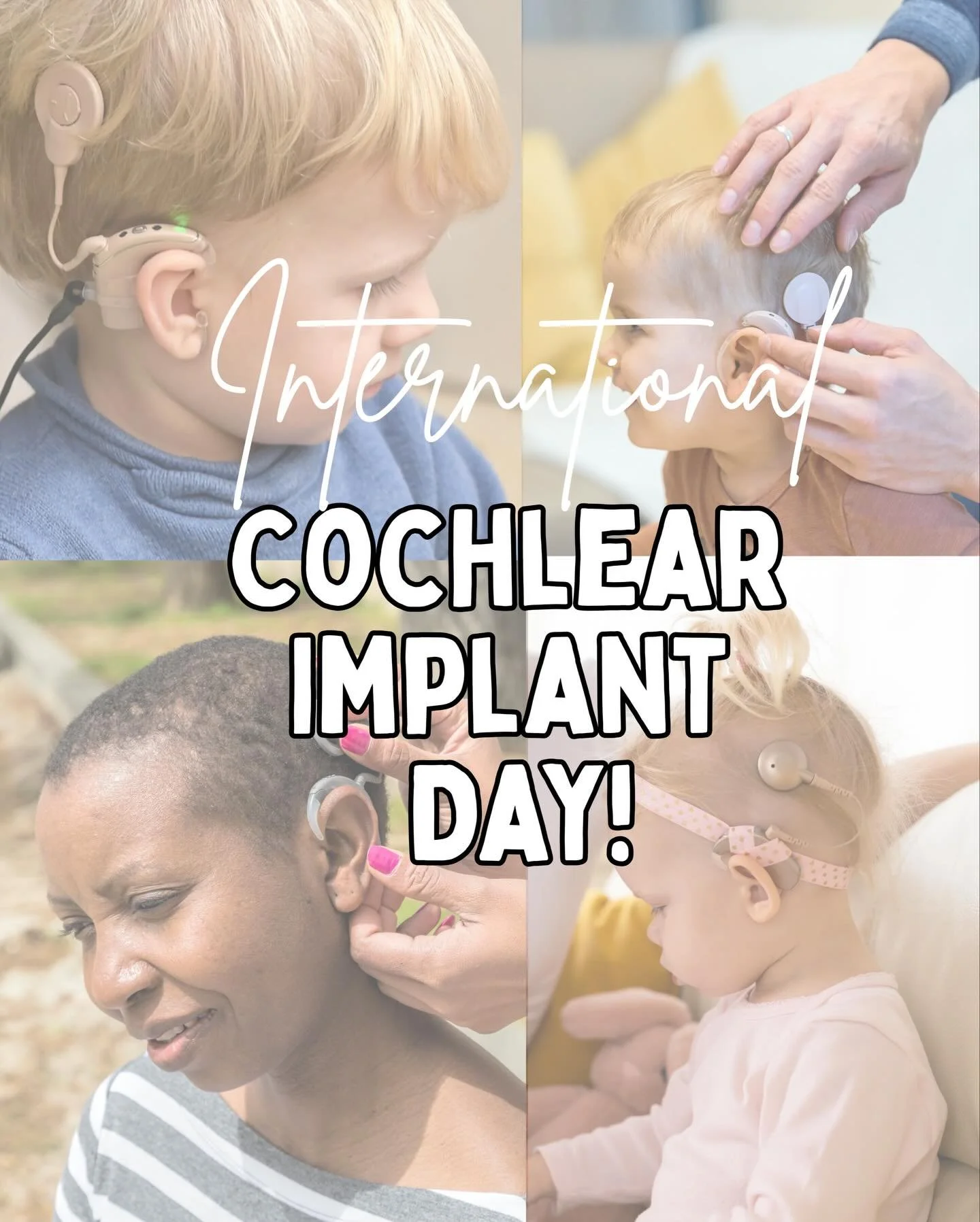 🎉 Happy International Cochlear Implant Day! 🎉
 Today we&rsquo;re celebrating the amazing technology that helps some people hear the world in a whole new way. 

Swipe through fun facts to learn more about what cochlear implants are, how they work, a