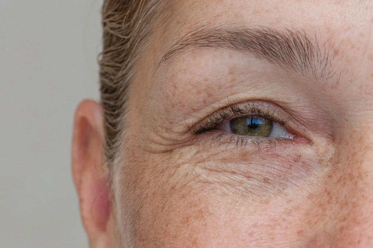 Why Everyone Is Talking About GLP-1 Skincare (And What It Means for Your Clinical Study)